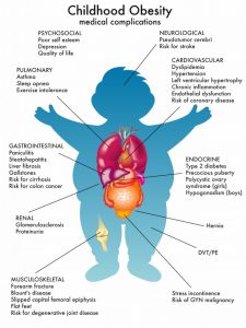 Childhood Obesity Medical Complications – Source: Millennium Family Practice